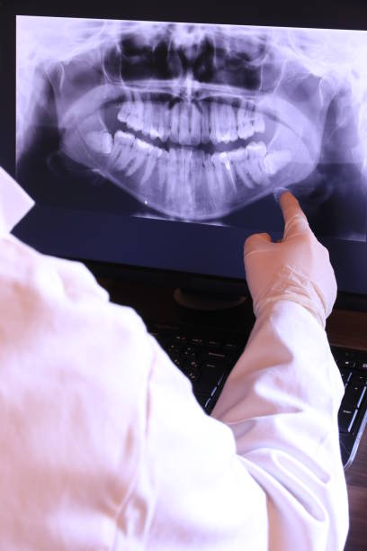 Best Emergency Root Canal Treatment in Iron River, MI