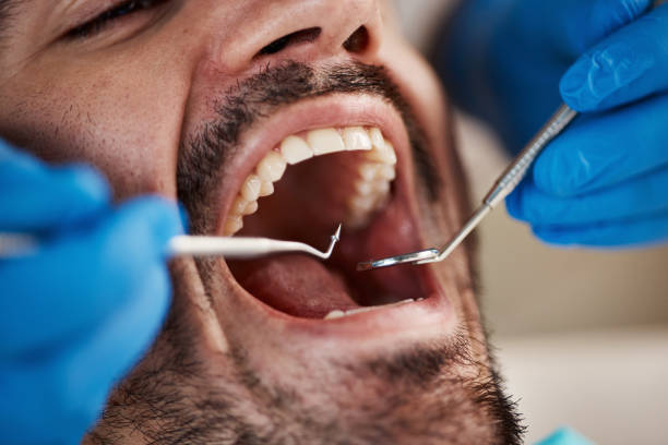 Best Emergency Treatment for Toothache in Iron River, MI